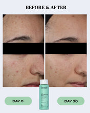 Load image into Gallery viewer, Pore Refining Exfoliating Toner | CLEAR