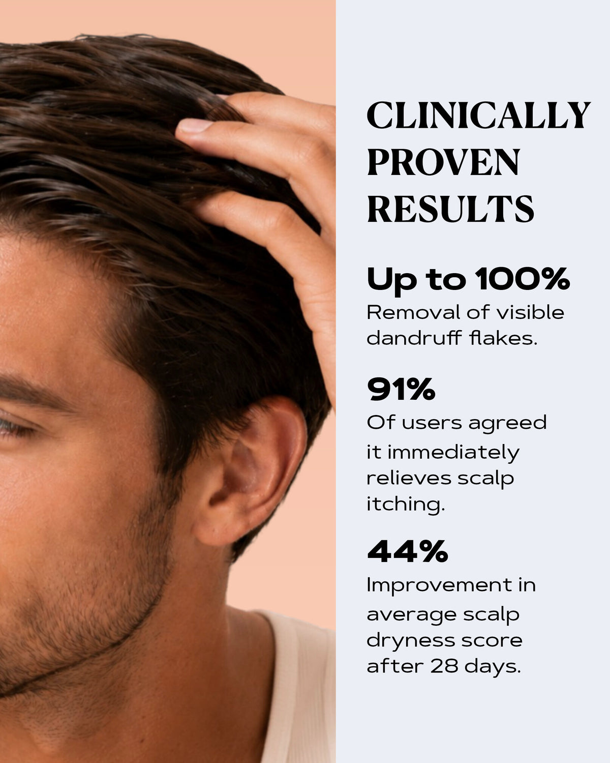 Anti-Dandruff Shampoo | SCALP CONTROL