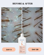 Anti-Dandruff Shampoo | SCALP CONTROL