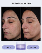 Soothing Moisturizer for Sensitive Skin | BIO BALANCE