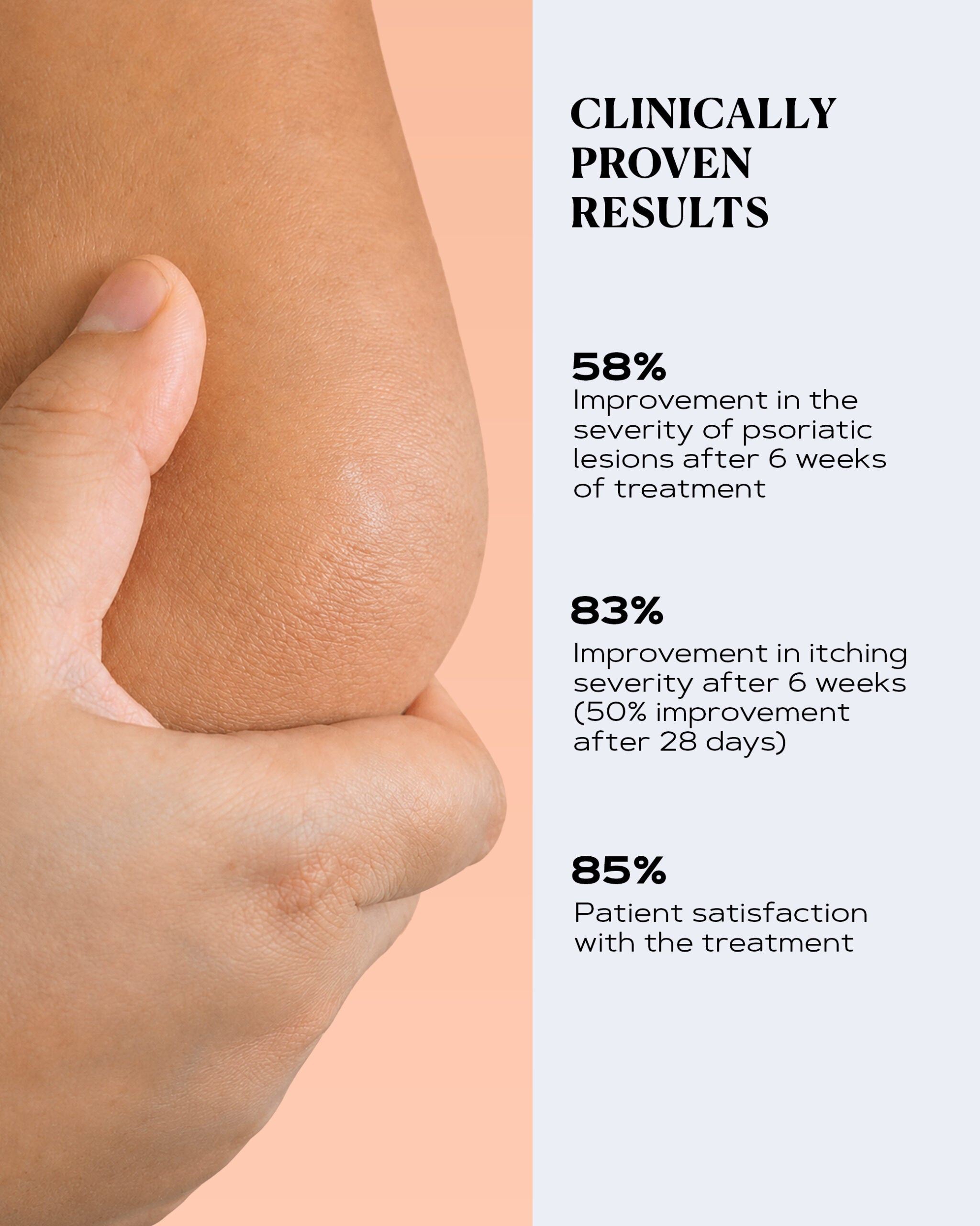 PSO CONTROL rich body cream – Multi-Symptom Relief for Dry & Flaky Skin