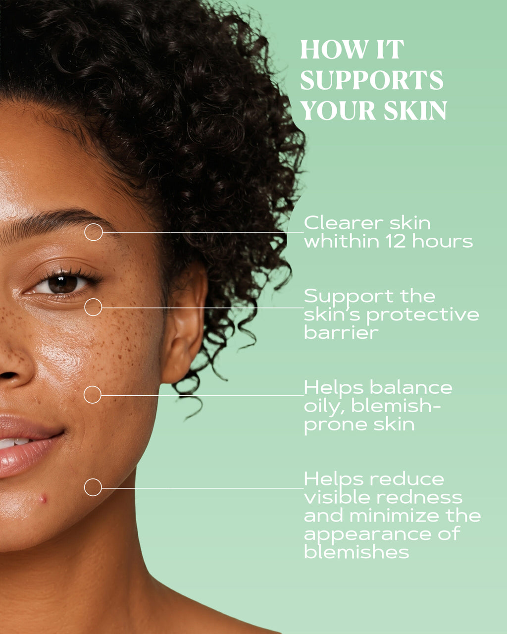 Pimple Relief Spot Treatment | CLEAR