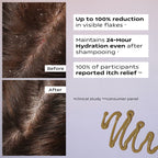 Ultimate Anti Dandruff Kit | SCALP CONTROL