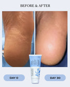 Intensive Hydrating Foot Gel | CALM